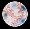 Что нужно знать о гемофильной инфекции