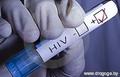 Оперативная информация о выявлении ВИЧ-инфекции на территории Брестской области на 01.08.2016